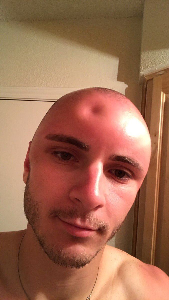 head a sunscreen for shaved