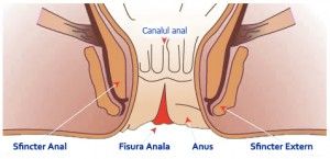 anal fissure itching