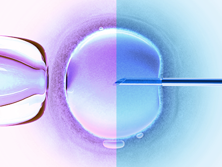 microsort sperm cost sorting