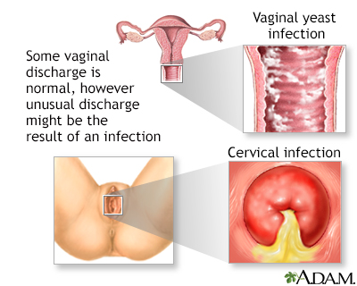 the vaginal on itching outside