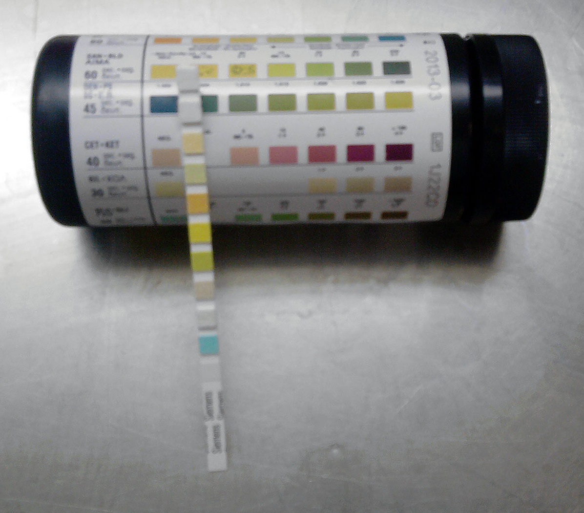 urinalysis strip glucose test