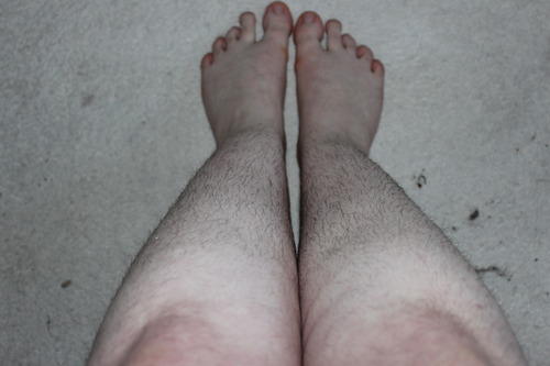leg very hairy