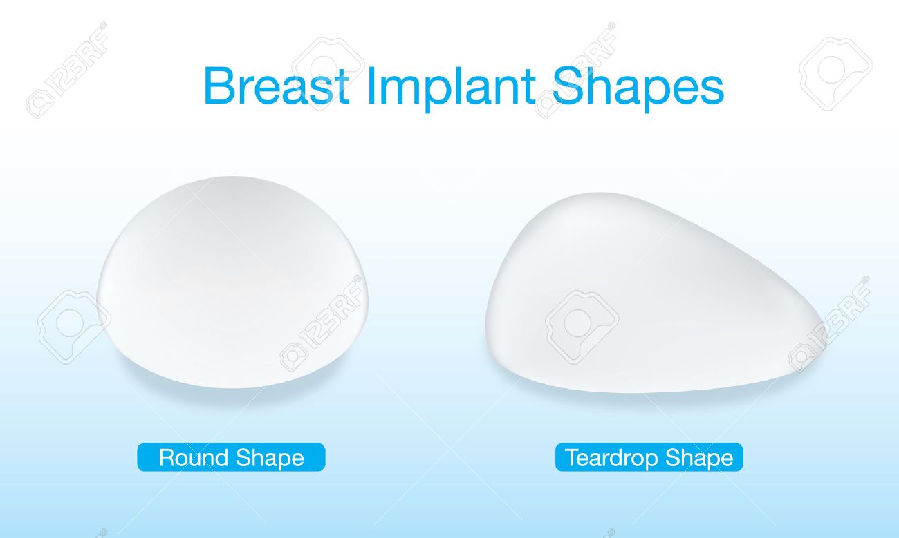 breast implant shapes